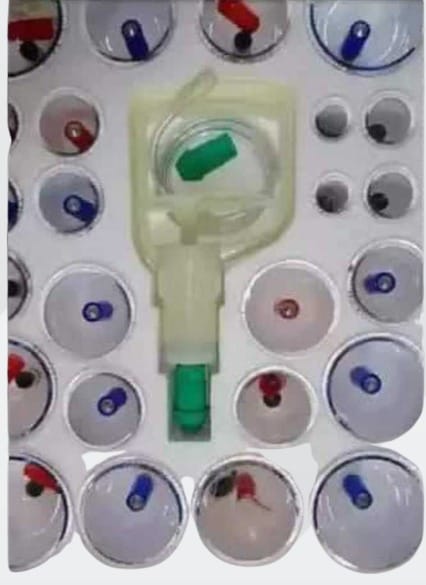 Cuping set